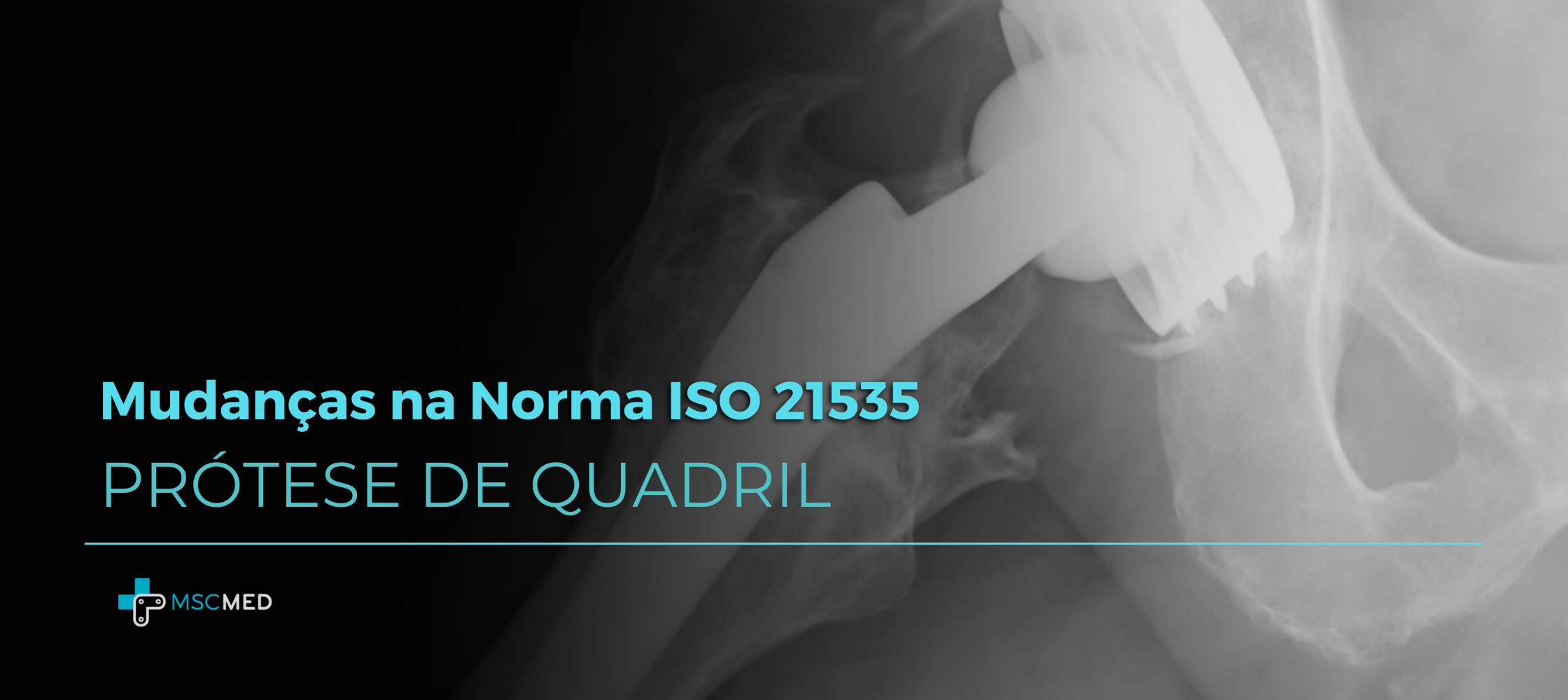 Mudanças na Norma ISO 21535 | Prótese de Quadril