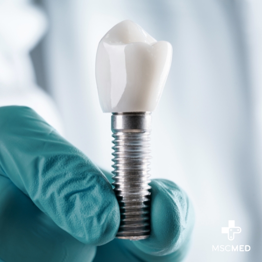 Análise de Segurança e Eficácia de Implantes Cirúrgicos