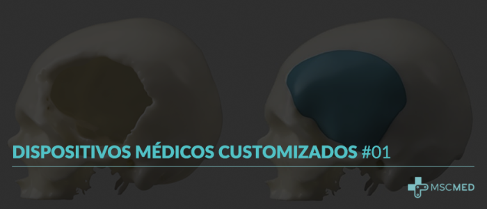 Dispositivos Médicos Customizados #01